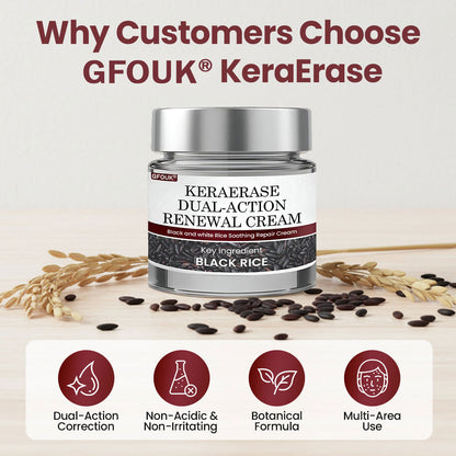 🔥Last Day 70% OFF🔥GFOUK® KeraErase Dual-Action Renewal Cream