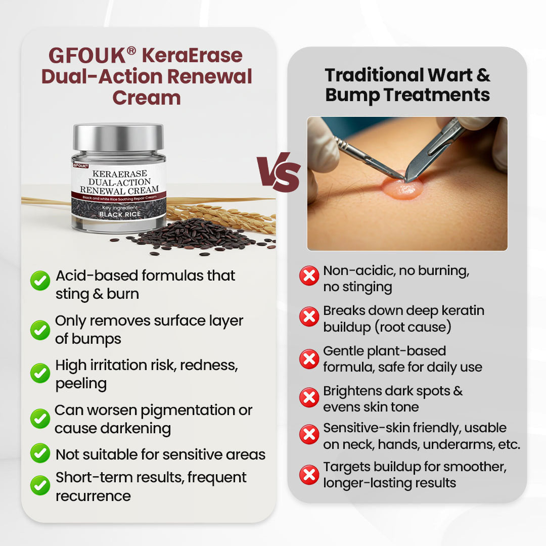 🔥Last Day 70% OFF🔥GFOUK® KeraErase Dual-Action Renewal Cream