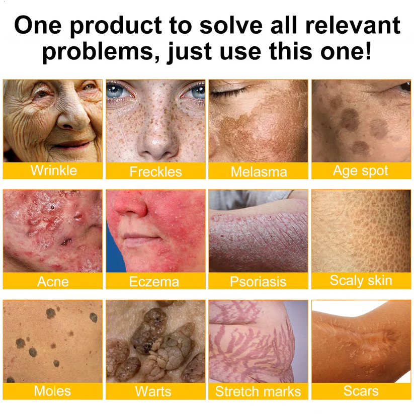🔥Enjoy 30% OFF for adding the second one