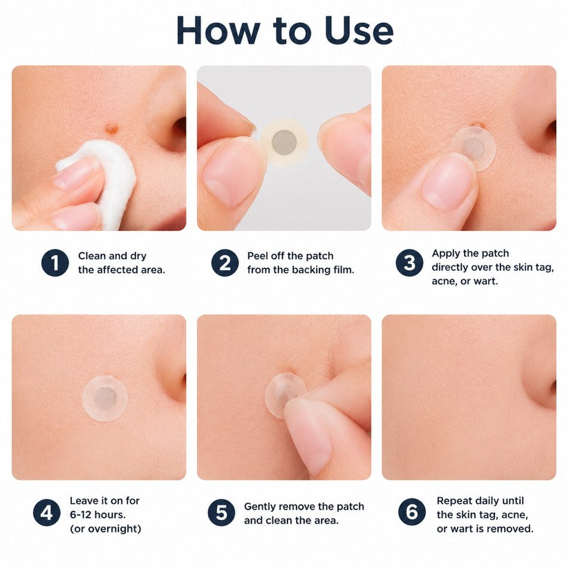 ✨GFOUK® 2-in-1 Microneedle & Hydrocolloid Patch🍀 | Removes raised moles, acne, flat warts, and skin tags | Helps improve wrinkles, scars, and blemishes | Invisible patches for face and body