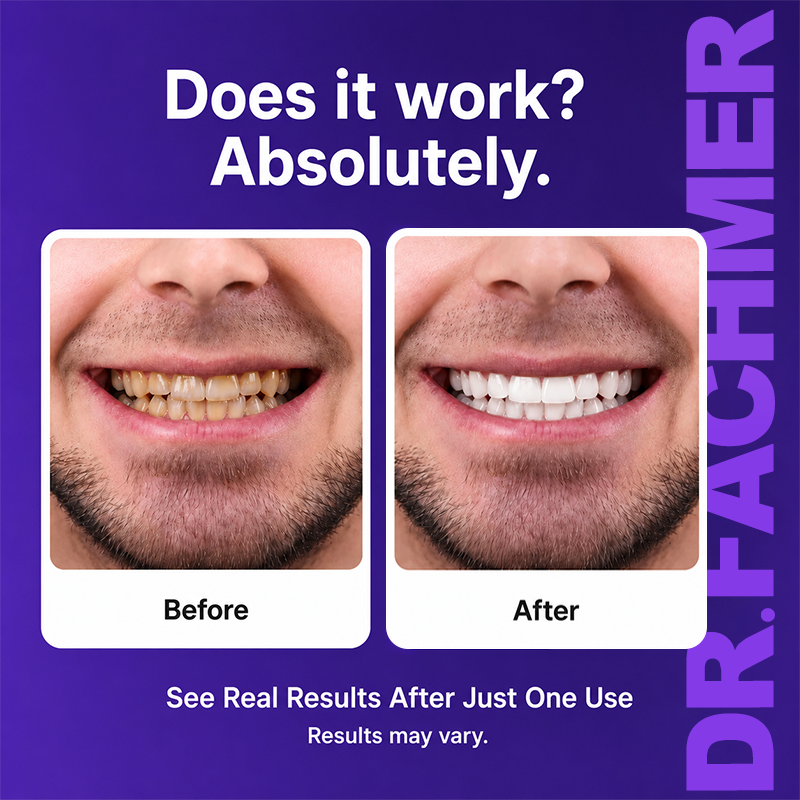 DR.Fachmer® Purple Teeth Whitening Strips
