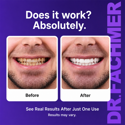DR.Fachmer® Purple Teeth Whitening Strips