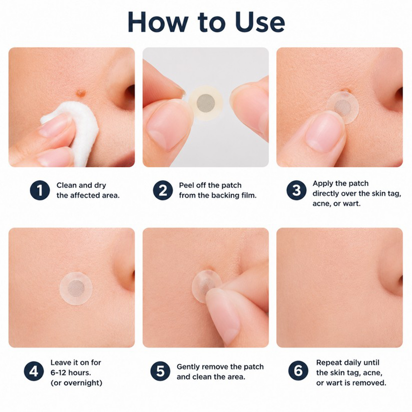 🔥GFOUK® 2-in-1 Microneedle & Hydrocolloid Patch🍀 | Removes raised moles, acne, flat warts, and skin tags | Invisible patches for face and body