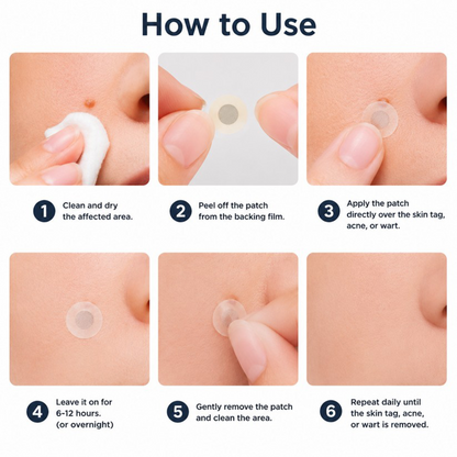 🔥GFOUK® 2-in-1 Microneedle & Hydrocolloid Patch🍀 | Removes raised moles, acne, flat warts, and skin tags | Invisible patches for face and body