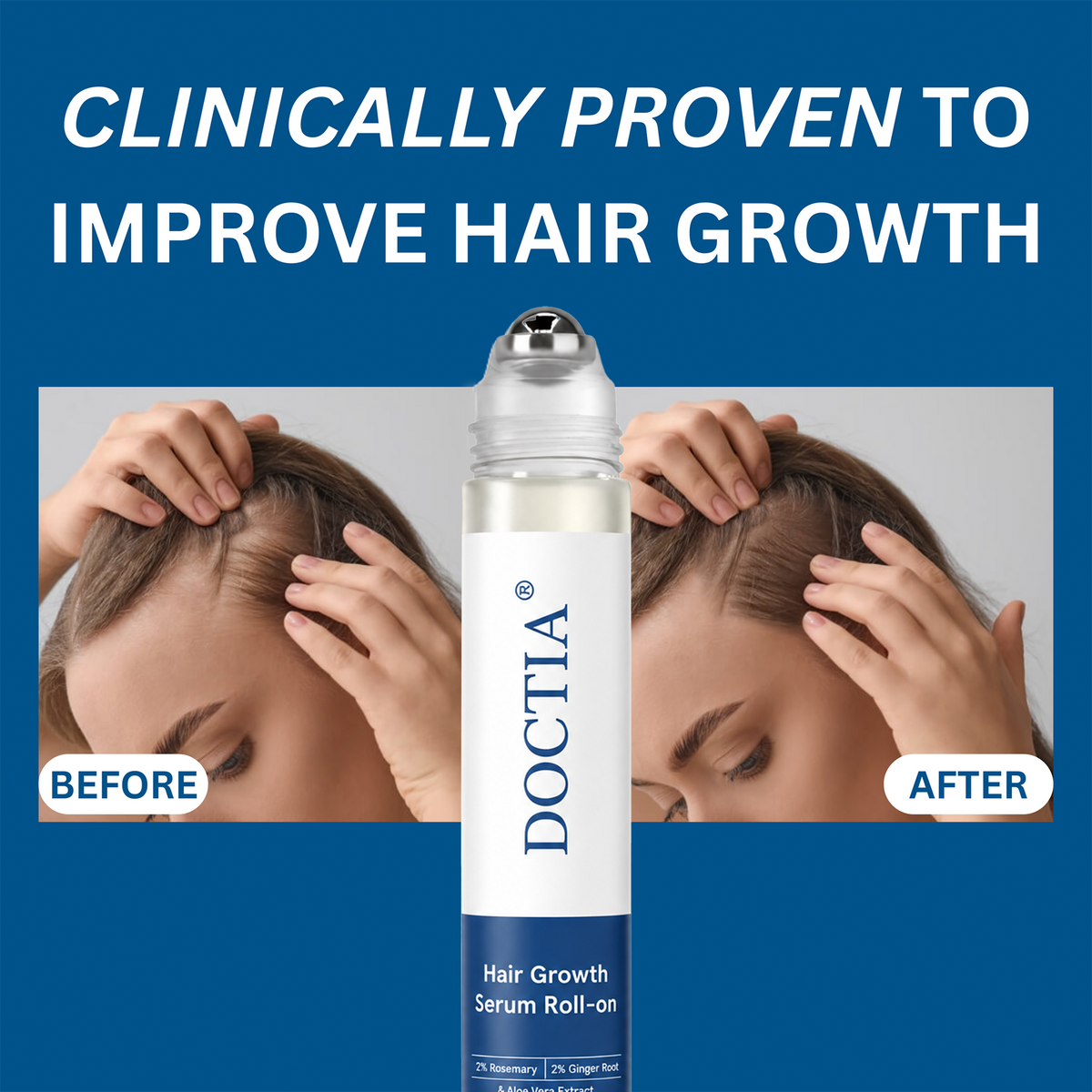 👍DOCTIA® Hair Growth Roll on Serum | For Hair Growth & Hair Loss Prevention