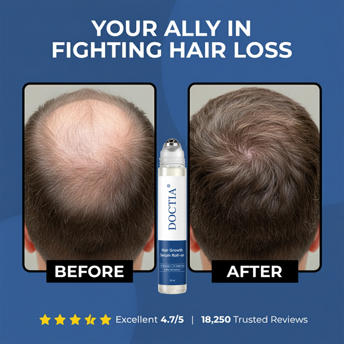 👍DOCTIA® Hair Growth Roll on Serum | For Hair Growth & Hair Loss Prevention