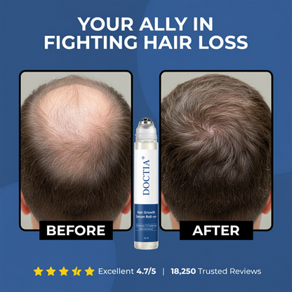 👍DOCTIA® Hair Growth Roll on Serum | For Hair Growth & Hair Loss Prevention