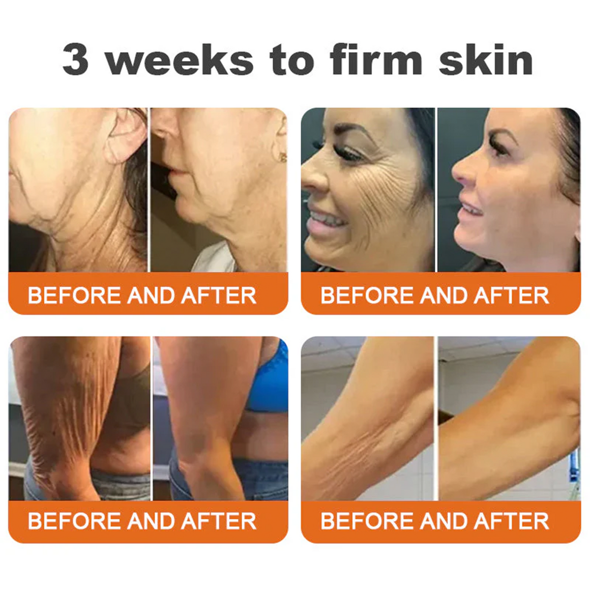 👨‍⚕️💎 Rolimey® Peptides & Vita-A Retinol Pro Comprehensive Cream🔥 —Tightening for Skin Types 🔥