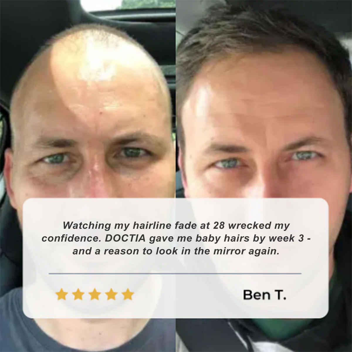 👍DOCTIA® Hair Growth Roll on Serum | For Hair Growth & Hair Loss Prevention