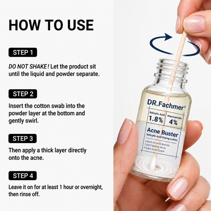 ⏰LAST DAY BUY 2 GET 2 FREE✨DR.Fachmer® 24H Acne & Pimple Treatment Drying Lotion | Inflammation Relief, Post-Blemish Care & High Pressure Pimple Relief